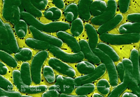 Vibrio vulnificus