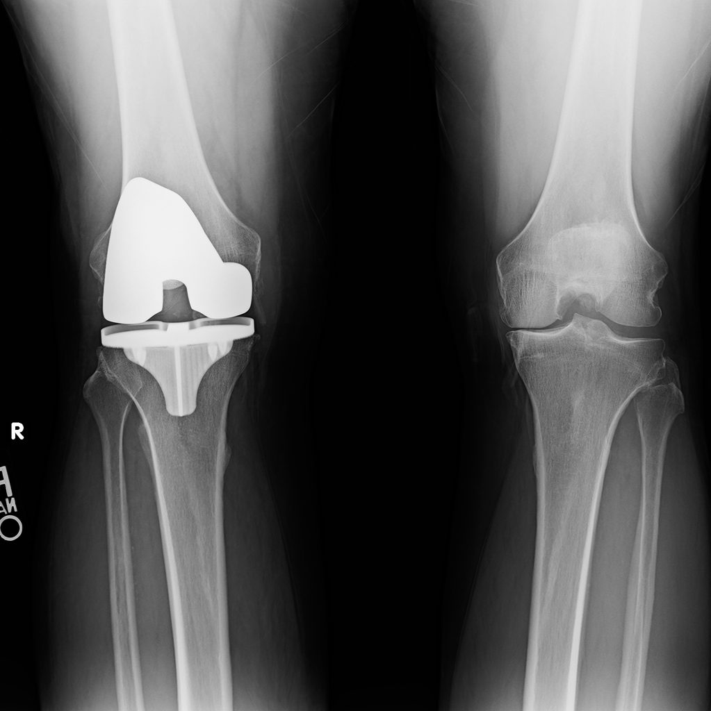 Knee-8_21_2026-2-1023x1024.jpeg
